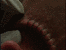 Head staples being inserted
