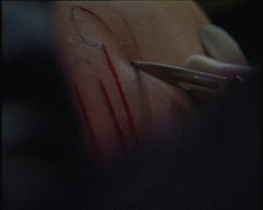 Scalpel: a question of documentary ethics